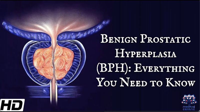 Benign Prostatic Hyperplasia ( BPH): Everything You Need To