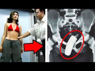 20 Strangest Things Discovered By X-Rays