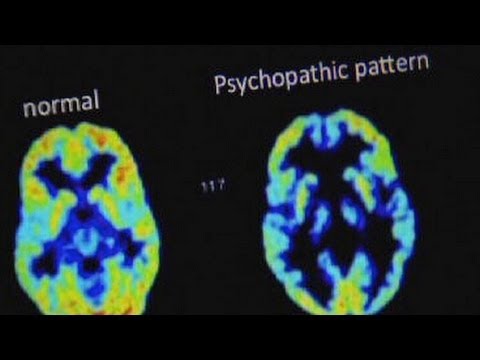 Inside the Brain of a Real Psychopath with Dr. James