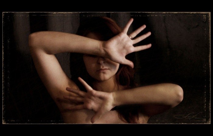 Kiss Dream | 