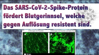 Gerinnselbildung „Clots“ durch Spike-Protein, Reaktion auf Studie #Blutgerinnung #Thrombozyten Clots