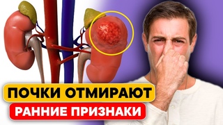 15 ранних Признаков того, что ваши ПОЧКИ ОТМИРАЮТ! 90% с проблемами ПОЧЕК даже не знают об этом