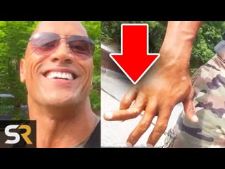 10 Popular Actors Who Damaged Their Bodies During Filming